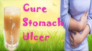 Cure Stomach Ulcer Naturally amp Permanently  Causes [upl. by Mikah563]