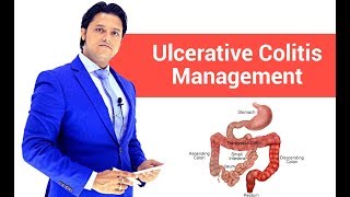 MRCP UK Part1  Ulcerative Colitis  Management [upl. by Treble]