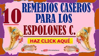 10 Remedios Caseros Para Los Espolones [upl. by Betta]