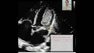 How to different Thrombusclotvegetationmyxoma Echo echocardiography By Babita [upl. by Iolande]