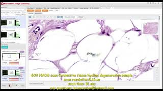 Whole slide image Digital pathology 60X NA0 8 scan Connective tissue hyaline degeneration sample [upl. by Edee]