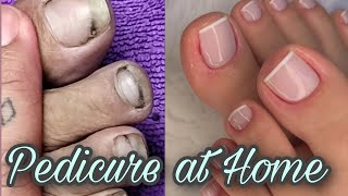 Pedicure at home Transformation from dirty to clean nails  Pedicure followingmydream [upl. by Ayotahs]