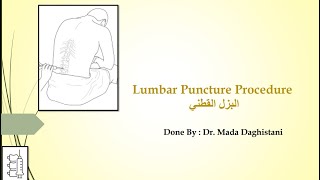 Lumbar Puncture Procedure  البزل القطني [upl. by Ika]