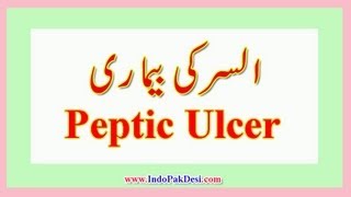 Peptic Ulcer Disease In UrduHindi Dr Rizwan [upl. by Airehs]