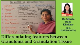 Granuloma vs Granulation tissue Differentiating features between Granuloma and Granulation tissue [upl. by Valerle]