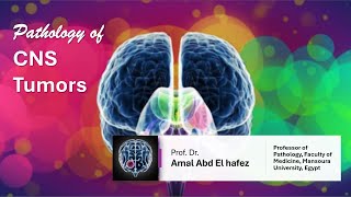 CNS Brain TumorsNeoplasms شرح محاضرة [upl. by Eednyl745]