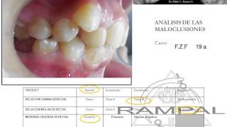 Diagnostico y Plan de Tratamiento N°52 [upl. by Ori]