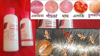 Lindane Lotion U S P  চুলকানি পাচডা ইতাদি বাংলা [upl. by Esiahc]