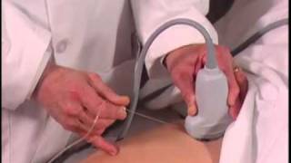 Ultrasound Guided Hip Injection SonoSite [upl. by Cott198]