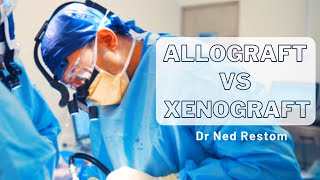 Interview with Dr Ned Restom  Allograft vs Xenograft [upl. by Aseefan]