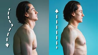 How I Fixed My Terrible Posture  5 Habits [upl. by Enajaras84]