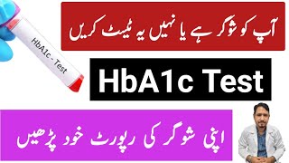 What is HbA1c Test Urdu Hindi Normal Range of HbA1c Test kya hota hai  Irfan Azeem [upl. by Arerrac827]