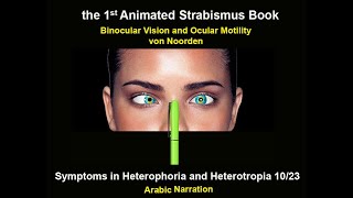 Symptoms in Heterophoria and Heterotropia and the Psychological Effects of Strabismus [upl. by Ttsepmet]