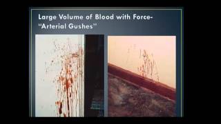 Blood Spatter Analysis Lecture  part 2 [upl. by Ecnerrot]