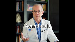 Acanthosis [upl. by Corrina]