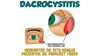 Dacryocystitis  Symptoms  Causes  Treatment [upl. by Sewoll]