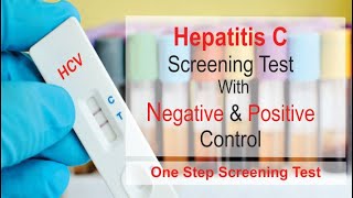 HCV One Step Screening Test [upl. by Akim323]