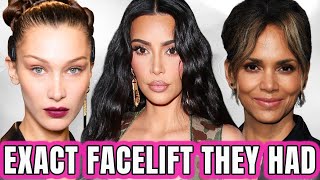 What Facelift Did Kim Kardashian Bella Hadid Madonna and Halle Berry Get With Dr Gary Linkov [upl. by Lacagnia]