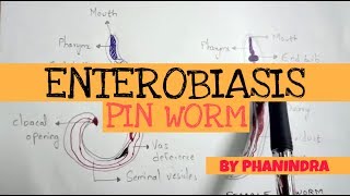 ENTEROBIASIS  PINWORM  STRUCTURE  LIFE CYCLE  SYMPTOMS  BY PHANINDRA GUPTA [upl. by Maon]