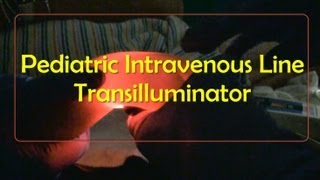 Pediatric Intravenous Line Transilluminator [upl. by Eidlog]