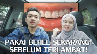 KENAPA KITA PAKAI BEHEL  MY DAMON CLEAR BRACES STORY 2 [upl. by Eesac664]