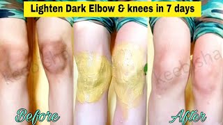 Lighten Dark Knees and Elbows Fast naturally at home  Dark Knees Home Remedies  keebisha [upl. by Cirdek]