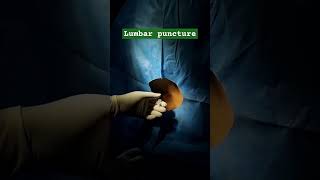 Lumbar puncture lumbarpuncture lumbarpunctureprocedure TechhealthOT [upl. by Maudie]