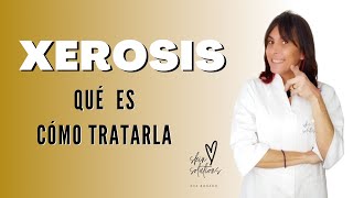 Piel Seca o Xerosis 🤔 Qué es la Xerosis y Cómo Tratarla [upl. by Dela591]