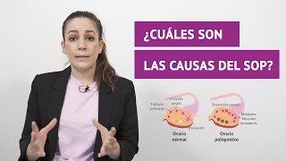 ¿Cuáles son las causas del Síndrome de Ovarios Poliquísticos SOP [upl. by Alaaj455]