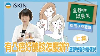 有凸疤增生型疤痕好醜怎麼辦？盧靜怡醫師這樣說，快筆記｜盧靜怡醫師 [upl. by Pedro343]