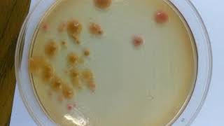 Salmonella Positive  Salmonella Shigella Agar [upl. by Atiuqan]