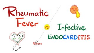 Rheumatic Fever vs Infective Endocarditis  Comparison  Cardiology Series [upl. by Noel]