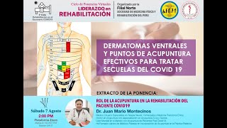 Dermatomas Ventrales y puntos de Acupuntura Efectivos [upl. by Tema699]