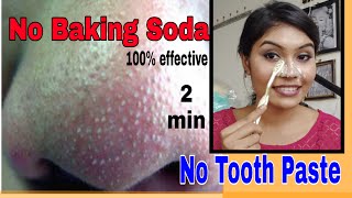 Remove BLACKHEADS  WHITEHEADS at home in just 2 minutes  best amp easy  no baking soda [upl. by Kruse]