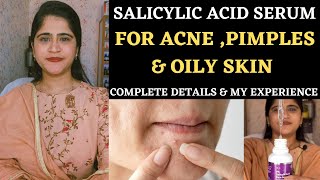 Salicylic Acid Serum 2॥ Really Effective or not ॥ Salicylic acid benefits for acne and pimples ॥ [upl. by Ateuqahs]