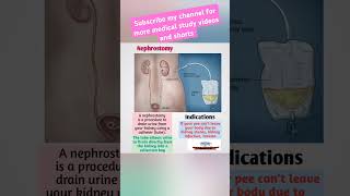 NephrostomyFreeMedicalEducationld3sfnursingmedicalviralviralshortsvideoyoutubeviralshorts [upl. by Lucias762]