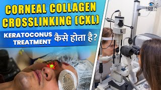 Corneal Collagen Crosslinking CXL Treatment कैसे होता है  Keratoconus Treatment Procedure [upl. by Caswell]