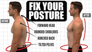 How To FIX Your Posture  10Minute Daily Routine [upl. by Eillat]