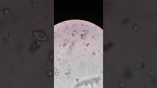 Calcium oxalate crystal under microscope  medicallabtechnologysajal6903 [upl. by Naxela]