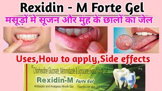 Rexidin m forte gel। मुंह के छालों का जेल। rexidin m forte gel how to use। mouth ulcer gel। [upl. by Sualokcin961]