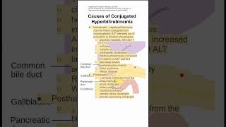 Causes of Conjugated Hyperbilirubinemia [upl. by Nanny]