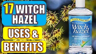 17 Surprising Witch Hazel Benefits amp Uses HEALTH  BEAUTY  CLEANING [upl. by Weed]