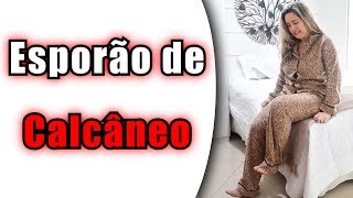 Dicas de Tratamento para Esporão de Calcâneo  Fascite Plantar  Aliviar a Dor [upl. by Yatnahc]