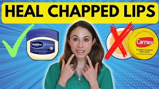 10 TIPS TO HEAL CHAPPED LIPS FAST 👄 Dermatologist DrDrayzday [upl. by Idnek638]