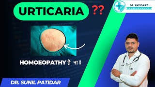 quotRelief from Urticaria Homeopathic Medicine by Dr Sunil Patidarquot [upl. by Atenek]