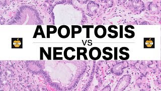 Apoptosis Intrinsic Extrinsic Pathways vs Necrosis [upl. by Notsew622]