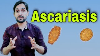 Ascariasis Infection  Ascaris Lumbricoides  Diagnosis  Life Cycle and Treatment [upl. by Secundas]