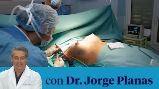 ¿Los implantes de senos son para toda la vida [upl. by Rolfston]