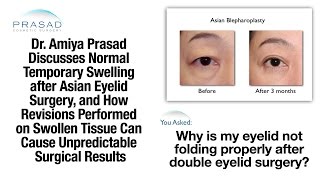 Why Double Eyelid Surgery Swelling can Take Months to Resolve amp Patience before Any Revision [upl. by Ellsworth885]