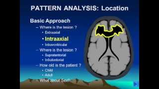 Brain Lesion Location Part 1flv [upl. by Housen778]